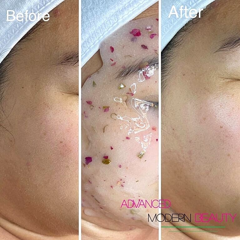 Skincare treatment before and after